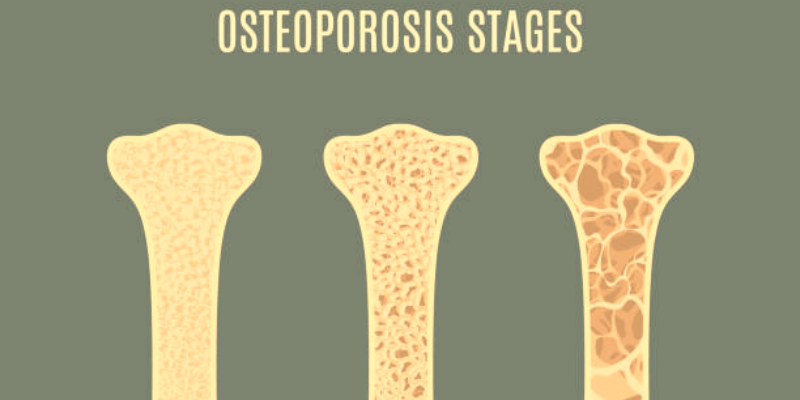 symptoms osteoporosis